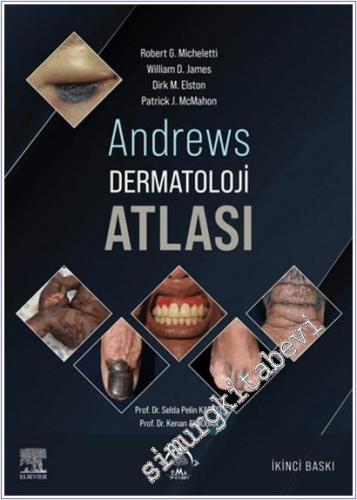 Andrews Dermatoloji Atlası -        2025