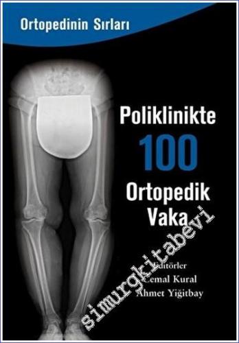 Poliklinikte 100 Ortopedik Vaka -        2023