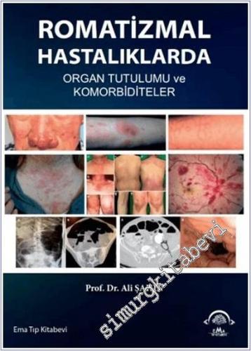 Romatizmal Hastalıklarda Organ Tutulumu ve Komorbiditeler -        2025